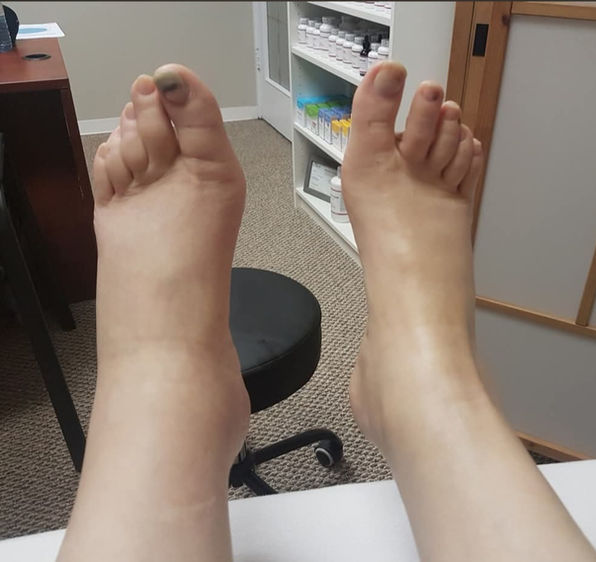 Manual lymphatic drainage result, image 1 of 3
