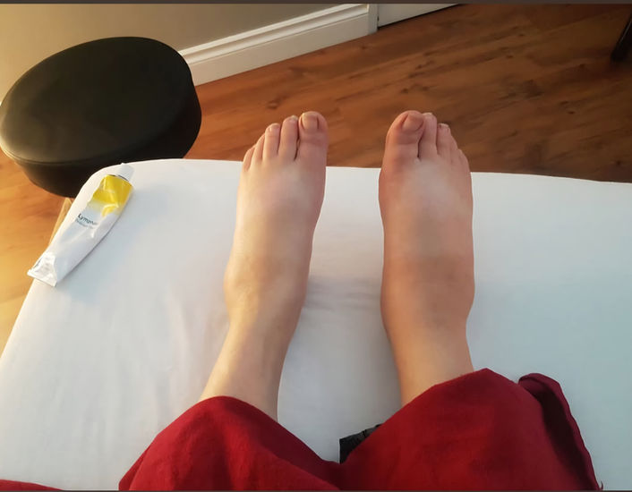 Manual lymphatic drainage result, image 3 of 3